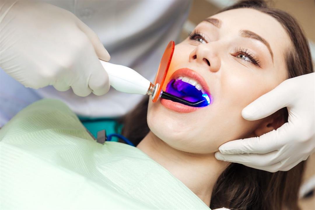 عملية تبييض الاسنان