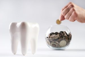 اهم المعلومات عن قيمة حشوة الاسنان وما هي أبرز أنواعها؟