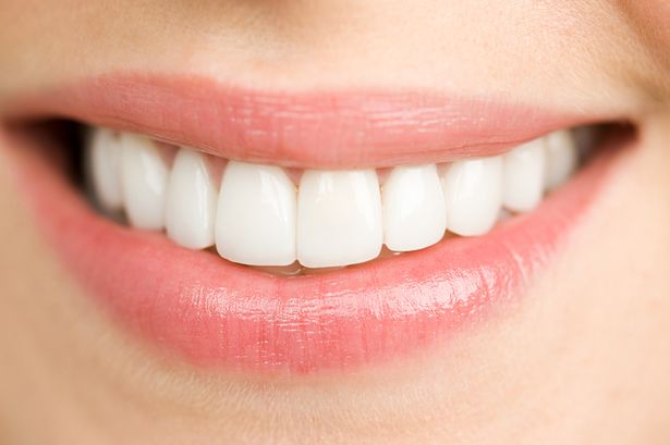 كم سعر تركيب اسنان هوليود وما هي أهم المزايا التي تقدمها للشخص؟