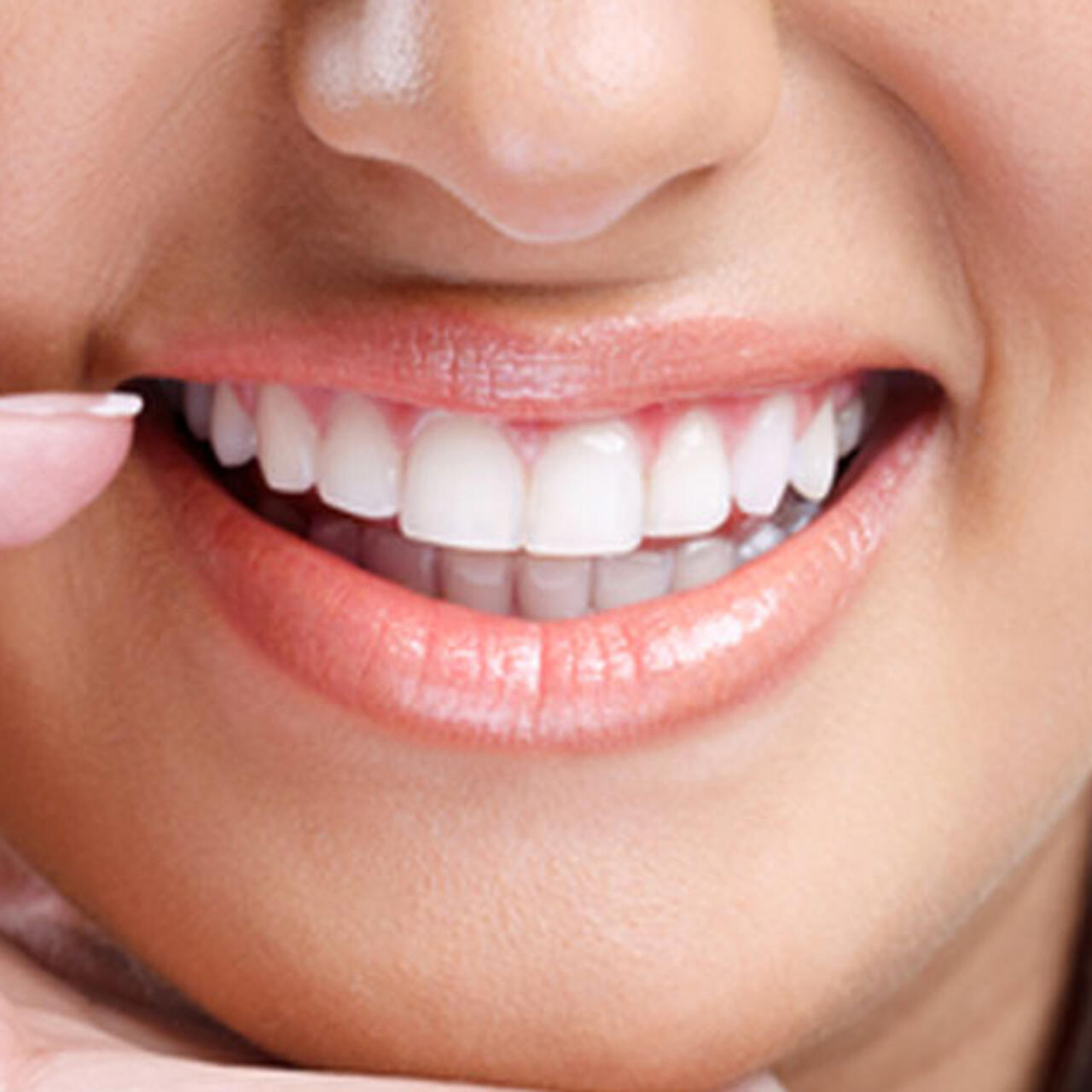 ما الفرق بين تنظيف الأسنان وتبييض الأسنان؟