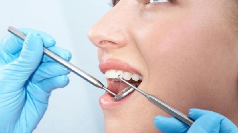 كيفيه إجراء حشو الاسنان الامامية