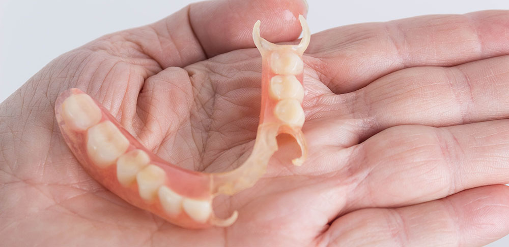 ما تعريف طقم اسنان جزئي متحرك