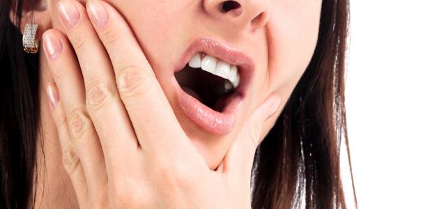 ما هي علامات تسوس الأسنان؟