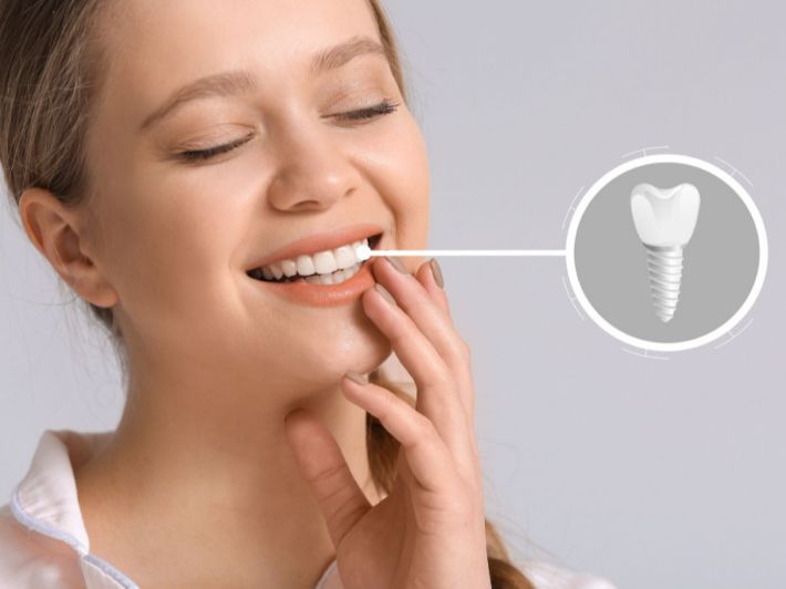 نصائح بعد تركيب فك اسنان