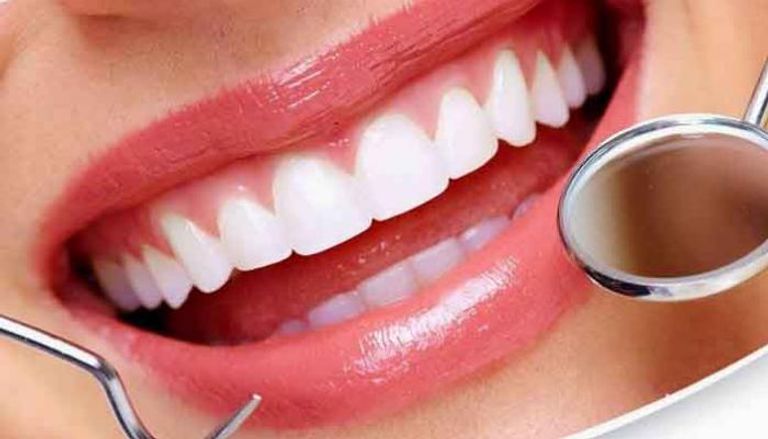 هل تنجح عملية تبييض الأسنان دائمًا؟