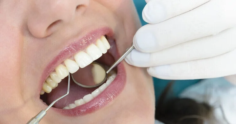 افضل مركز لعلاج و تجميل الاسنان