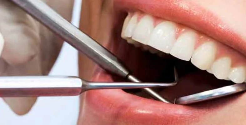 سلبيات تعديل الأسنان دون تقويم