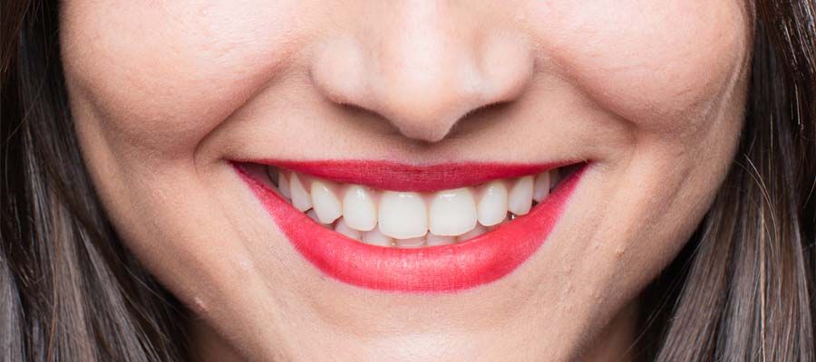 فوائد تركيب الأسنان في مصر