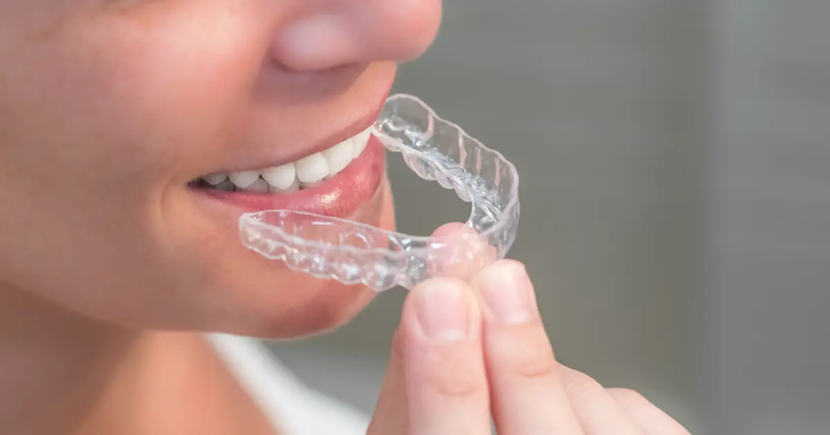هل يعطي تقويم الاسنان نتائج إيجابية؟