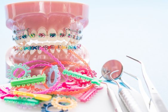 ما هي مكونات تقويم الأسنان
