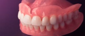 ما هو تقويم الاسنان الفك العلوي المتقدم وما هي تكلفته