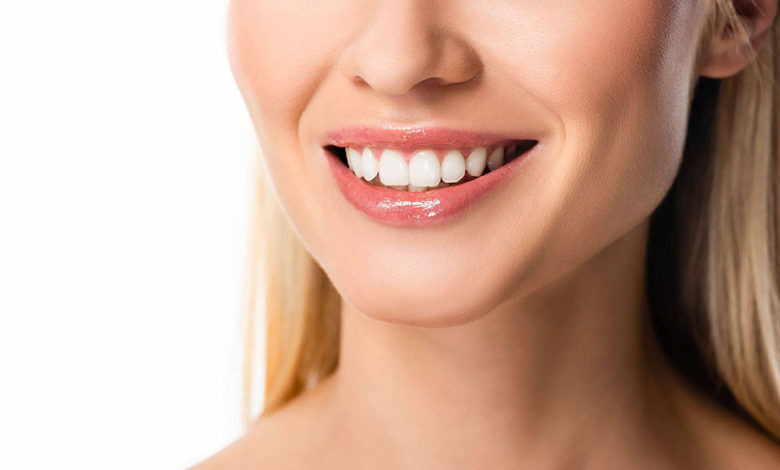 أنواع تركيبات الاسنان emax