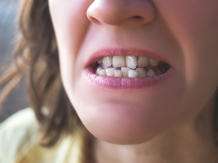 ما هي المضاعفات المحتملة لانحراف الأسنان؟