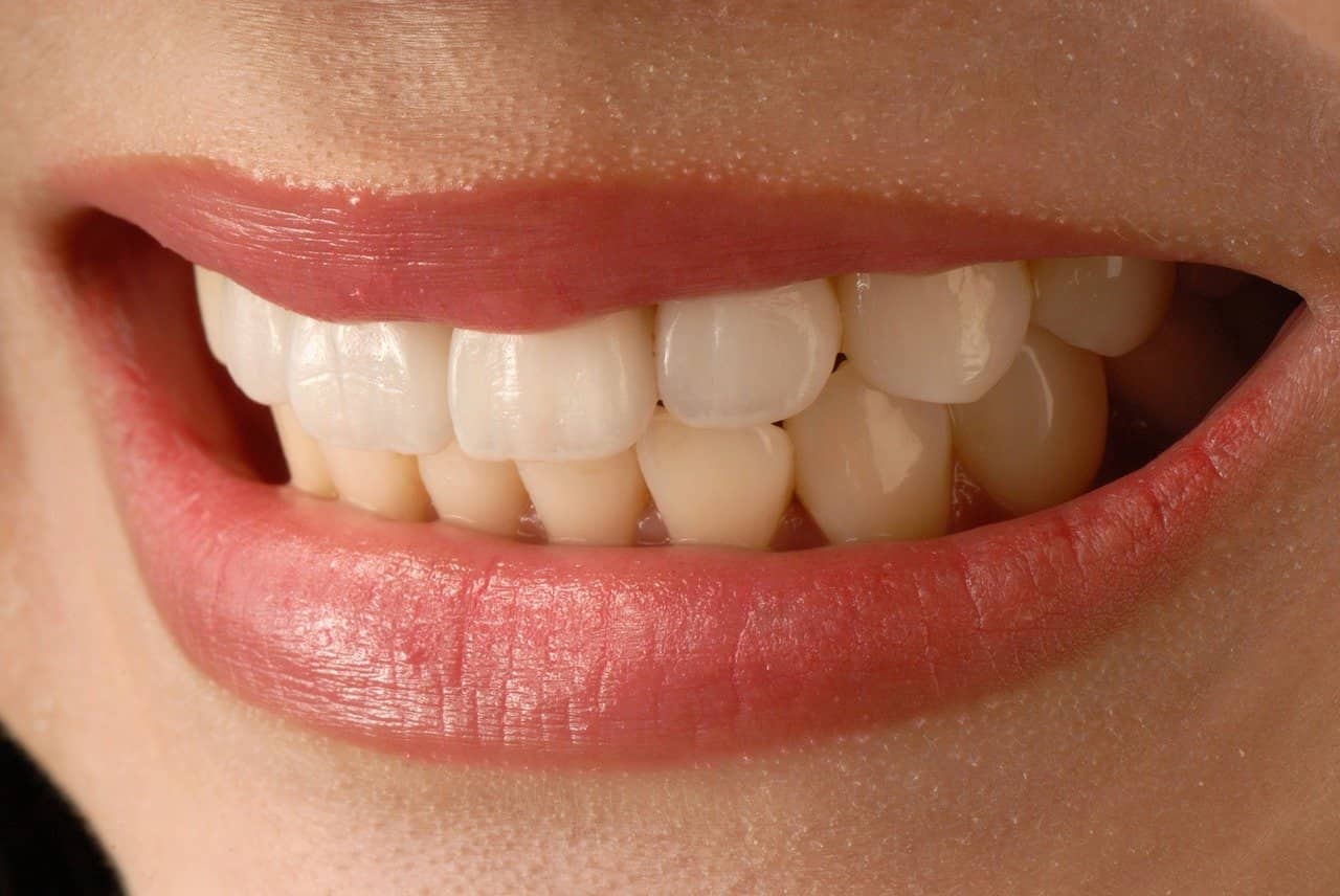 تعديل الاسنان الاماميه بدون تقويم