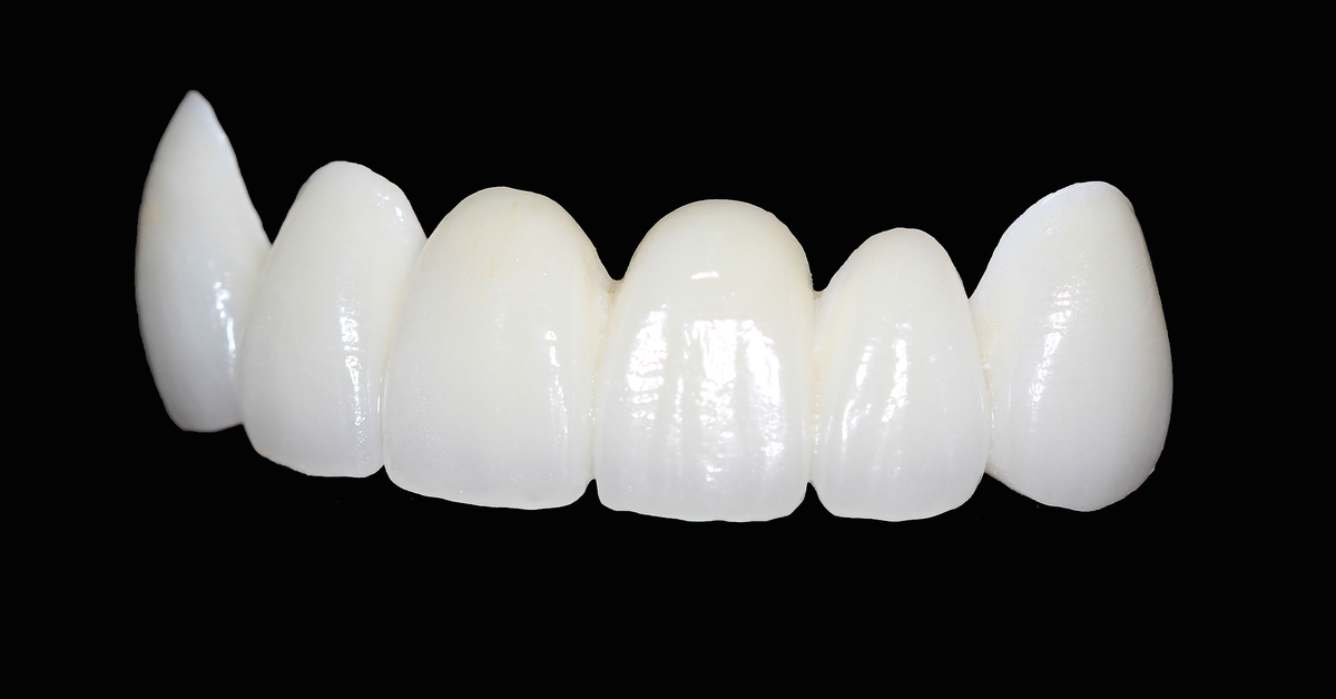 تعرف معنا على عروض تركيب اسنان زيركون وأفضل أنواعها!