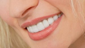 اكتشف المزيد عن قشره الاسنان فينير واستخدماتها!