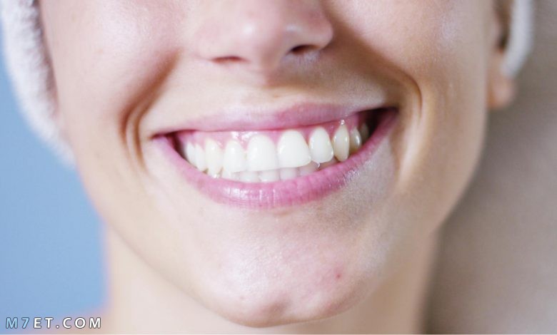 كيفية الوقاية من بروز الاسنان