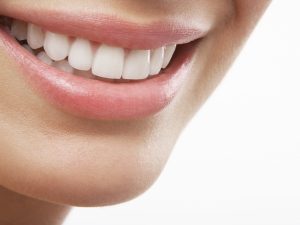 اكتشف أكثر عن ما معنى فينير الاسنان وما هي أشهر أنواعه؟