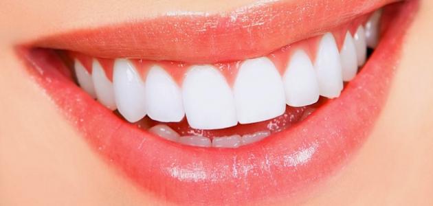 مميزات تجميل الأسنان بدون تقويم