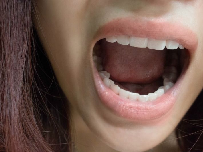 Getting rid of the smell of dental implants