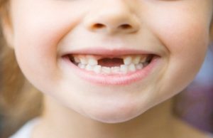 تعرف على متى تسقط الاسنان اللبنية ؟ وما هي مشاكل تبديل الأسنان عند الأطفال؟