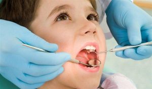 اكتشف أهم مسكن لوجع الاسنان للاطفال وما هي أسباب ظهور الألم؟