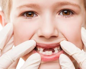 ما هو سن خلع الاسنان للاطفال وما تكلفة هذا الإجراء؟