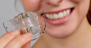 ما هو بديل لتقويم الاسنان وما هو مميزاته وعيوبه؟