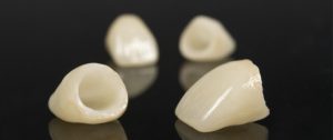 ما هي أنواع تركيبات الأسنان وأفضلها وكيف يمكن أن يتم تركيبها؟