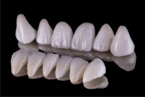 استكشف معنا انواع تركيبات الاسنان البورسلين وطرق العناية بها!