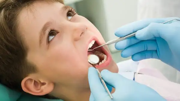 ازالة تسوس الاسنان هو خط الدفاع الأول والأخير لضمان صحة وسلامة الأسنان