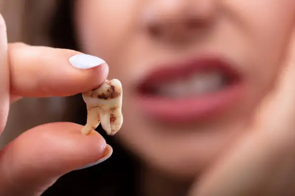 طرق الوقاية من تسوس الاسنان التي ينصح بها الأطباء - أسنان كير.كوم